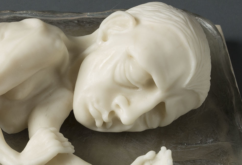 Sleeping Girl, (close up) 17″ x 11″ x 6″, carved kiln cast glass, 2014